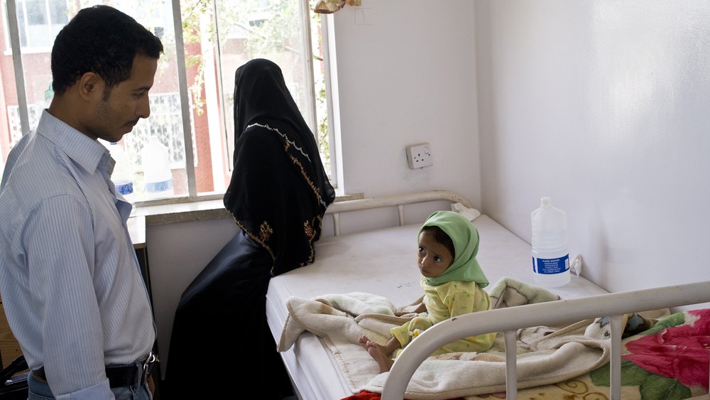 A malnourished girl at Sanaa(***)s al-Sabeen Hospital. Speaking about children suffering from malnutrition who arrive in his unit, Dr. Obei said, "Most of the cases arrive not from the city, but from the villages."
