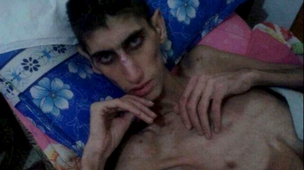 An emaciated man is seen in this undated picture taken from social media