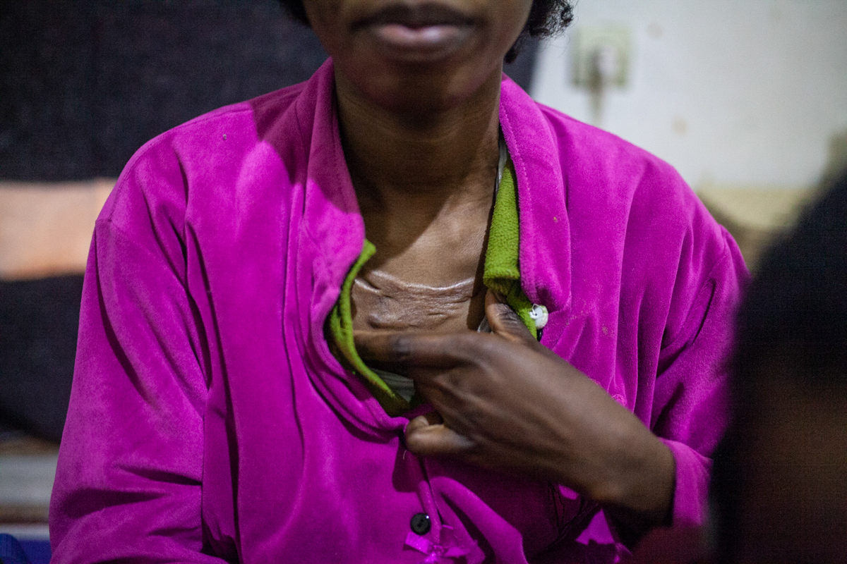 The scar that Christelle has on her neck reminds her of the reason why she fed from the Ivory Coast. When her father died, she remained as heir to the family home. Her paternal family did not agree an