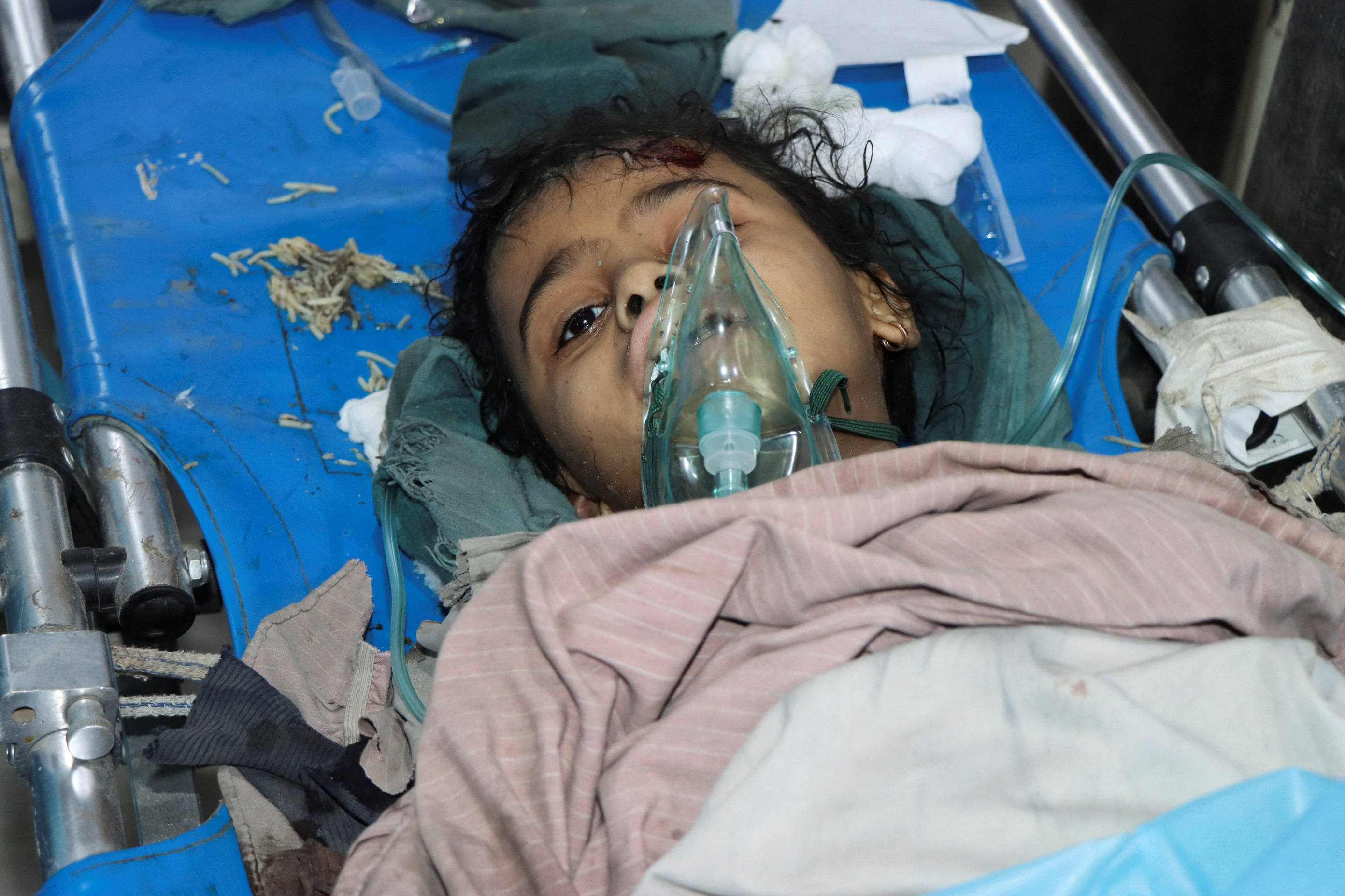 A girl injured by a U.S. strike lies on stretcher at a hospital in Saada