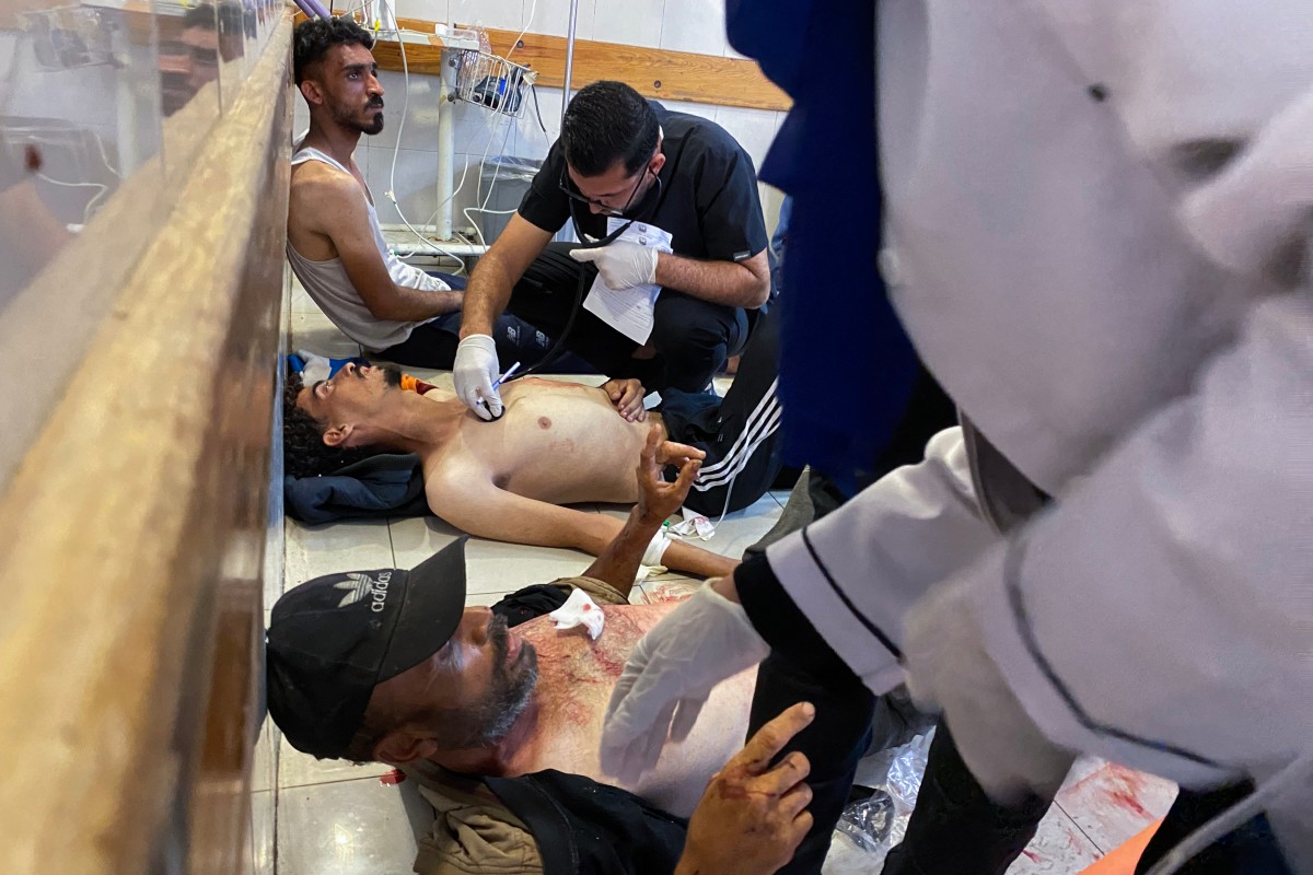Palestinians who were injured in Israeli fire as they gathered near a food aid centre, receive care at Khan Yunis' Nasser hospital in the southern Gaza Strip on June 17, 2025. Gaza's civil defence agency said Israeli forces killed at least 47 people and wounded more than 200, as thousands of Palestinians gathered to receive flour at an aid centre in the morning, adding "Israeli drones fired at the citizens... some minutes later, Israeli tanks fired several shells at the citizens, which led to a large number of martyrs and wounded". (Photo by AFP)