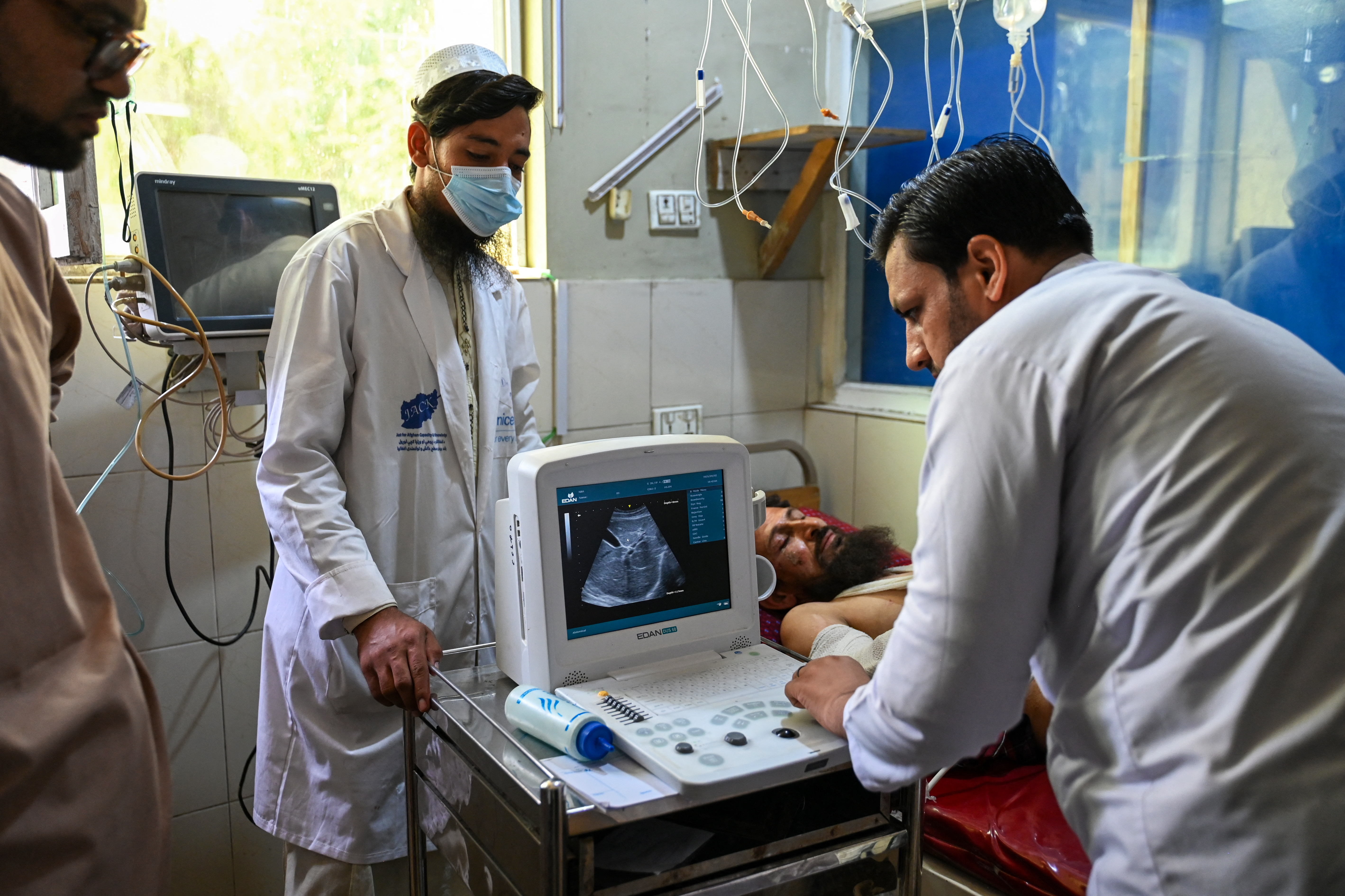 EDITORS NOTE: Graphic content / An Afghan man injured during earthquakes, receives treatment at a hospital in Jalalabad on September 2, 2025.