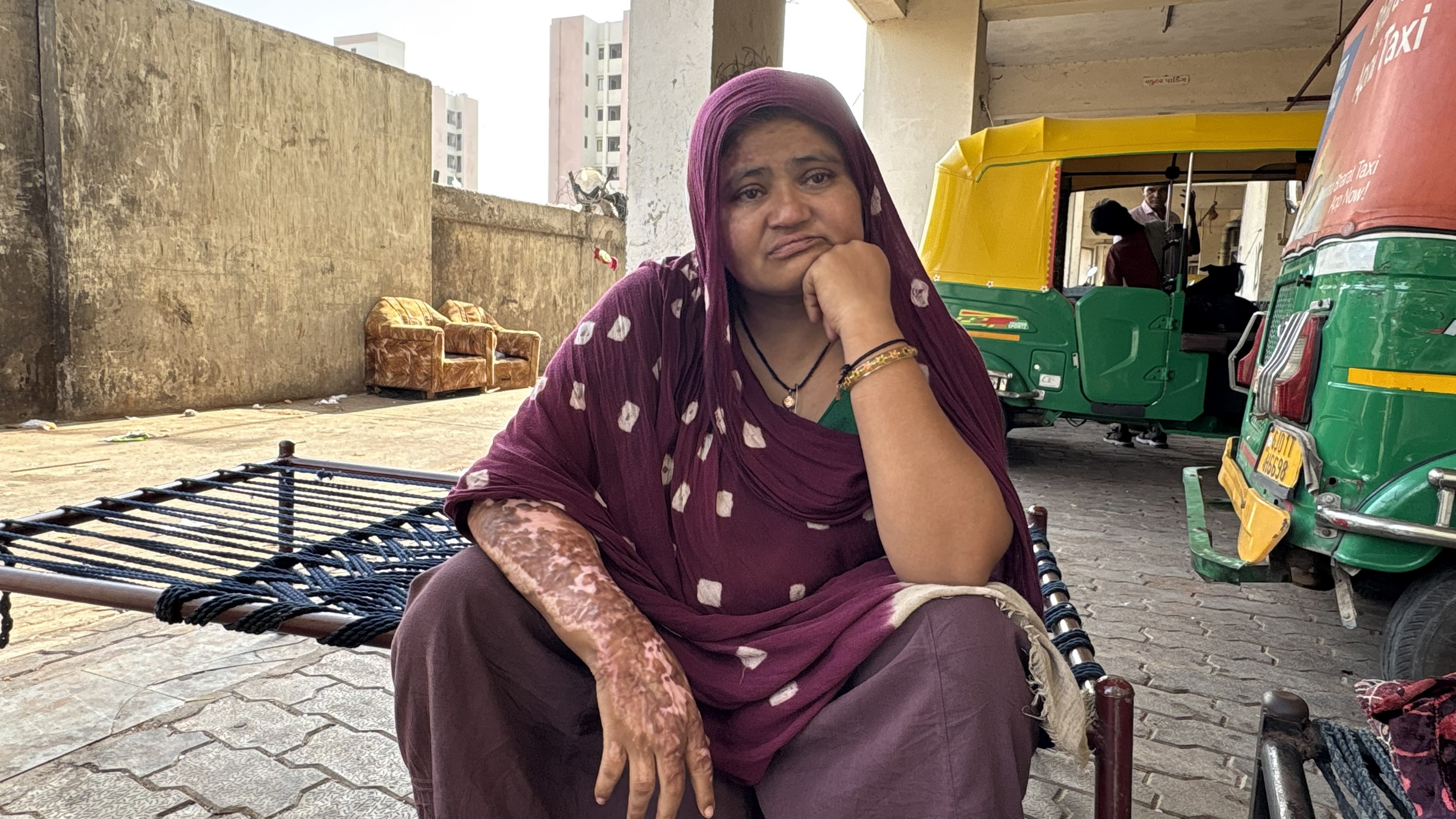 Sita Patni outside her house in Ahmedabad, the burn marks on her arm a reminder of her futile attempt to save her son, killed after Air India 171 crashed in June 2025 [Marhaba Hilali/ Al Jazeera]