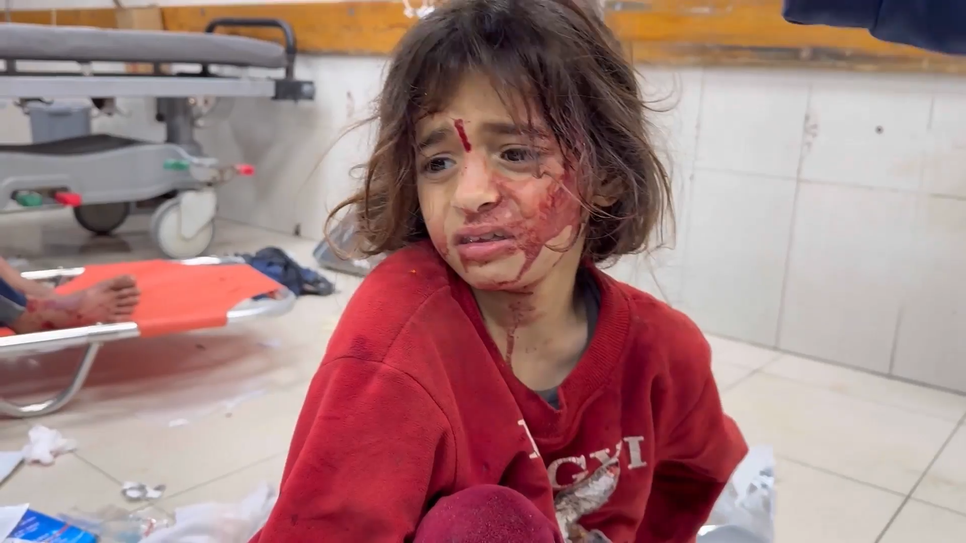 An injured child at Nasser Hospital after Israeli air strikes reportedly hit tents sheltering displaced Palestinians in al-Mawasi, Khan Younis, Gaza, March 18, 2025. [Screenshot from Viory file]
